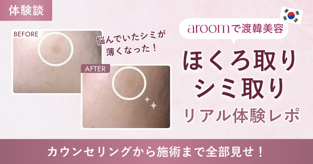 ほくろ取りシミ取りリアル体験レポ