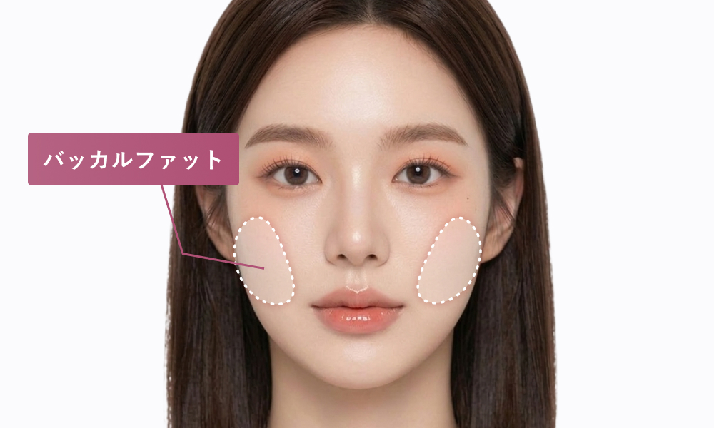 バッカルファット：頬の内側に位置する脂肪の塊で、特に頬の中央部分